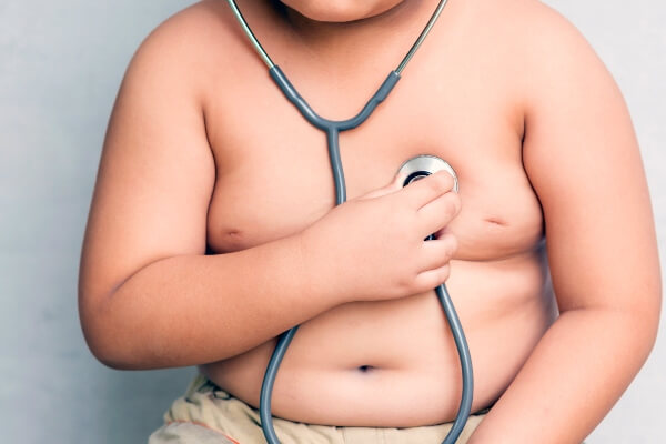 Obesidade infantil: o que você precisa saber - Hospital Sagrada Familia.